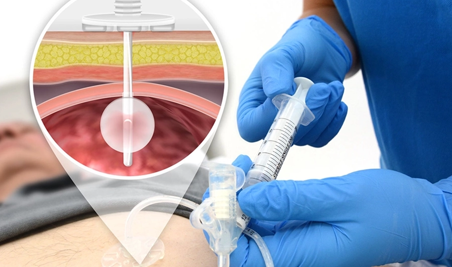 Evde Serum Uygulaması: Biyoteknolojik Serumlarla Sağlık ve Yaşam Kalitesini Artırın
