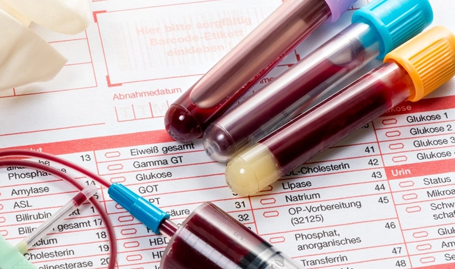 Genetik Testler ve Serum Terapisi: Sağlık İçin Kişiye Özel Çözümler
